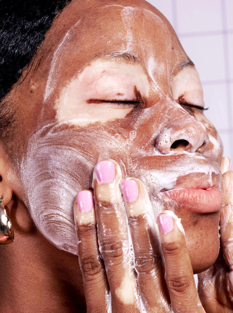 Model with vitiligo cleansing face with Wonder Clay